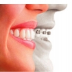 othodontist | Conil